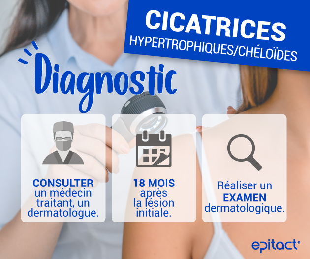 Diagnostic d’une cicatrice hypertrophique ou chéloïde - Epitact